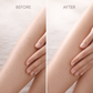 IceGlow IPL Hair Removal Device – At-Home Painless Laser Hair Removal System with Ice Cooling Technology, 999,999 Flashes & 9 Energy Levels for Full Body Use