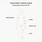 IPL hair removal full body treatment areas legs underarms bikini