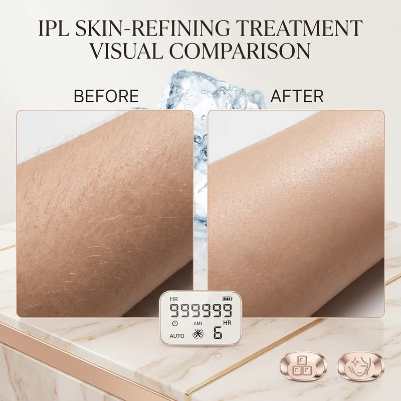 Lume Glows professional grade IPL machine for flawless and hairless skin